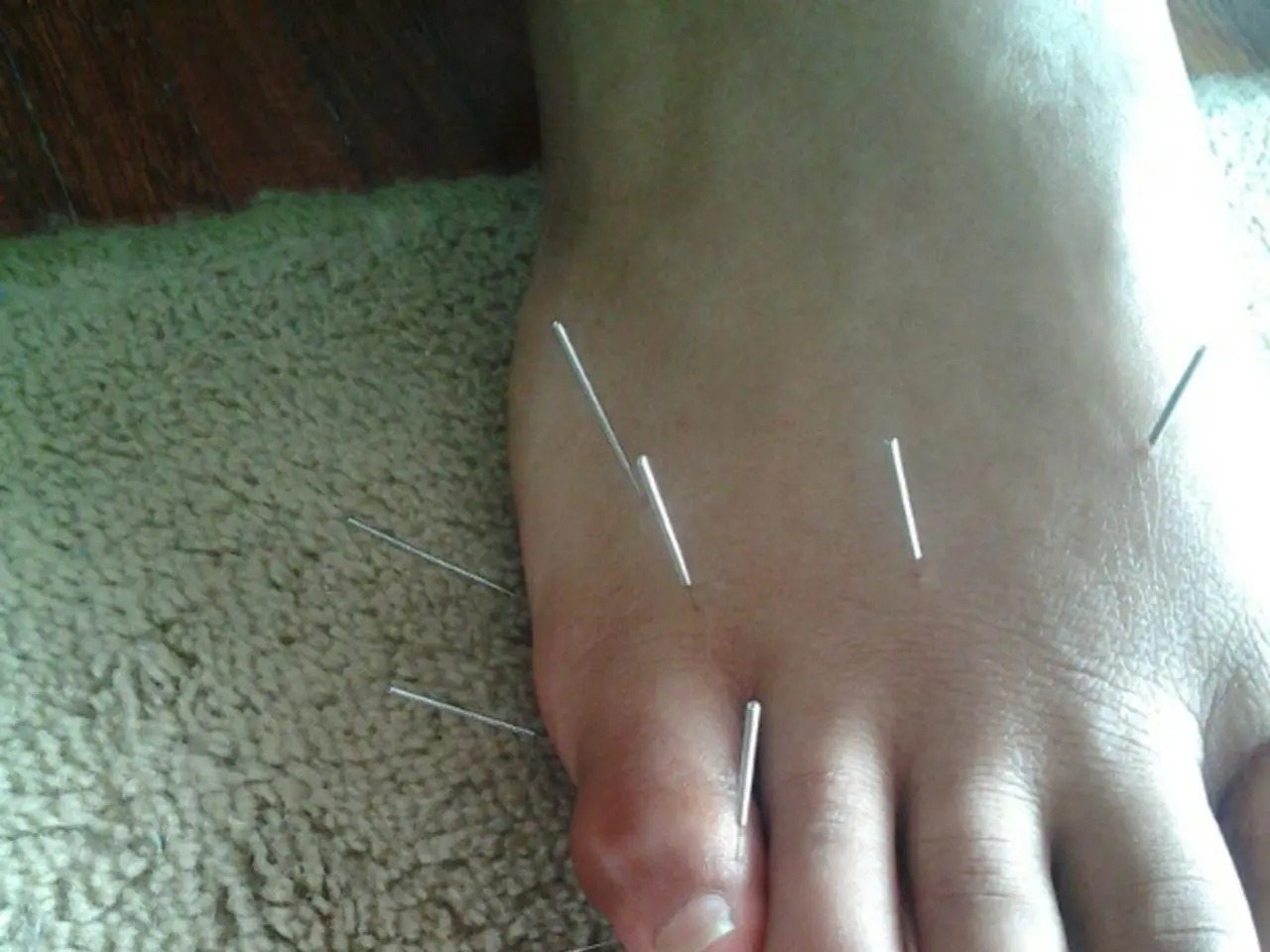 Understanding Connective Tissue Disorders: Classifications, Symptoms, and Further Information