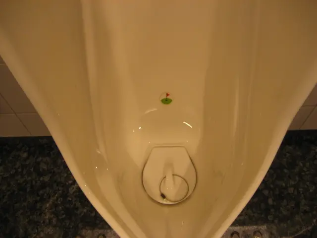 Urine Mucus: Origins, Diagnostics, and Remedies