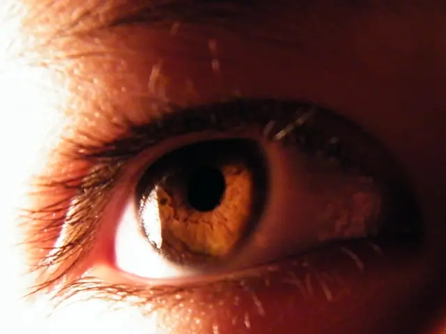 Eye-related Psoriasis: Symptoms, Origin, and Remedies