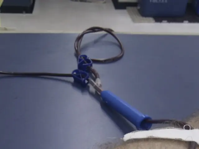 Timeline for Shedding of Tonsillectomy Scabs: What Can Be Expected?