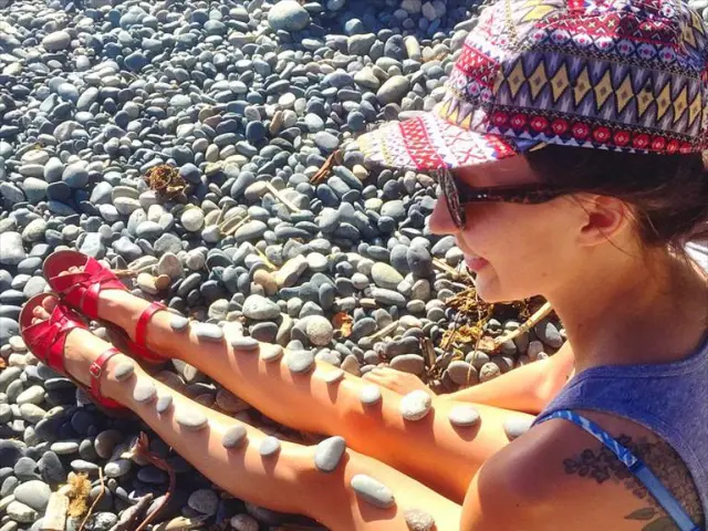 Experiencing urinary stones is considered more painful than childbirth by some individuals.