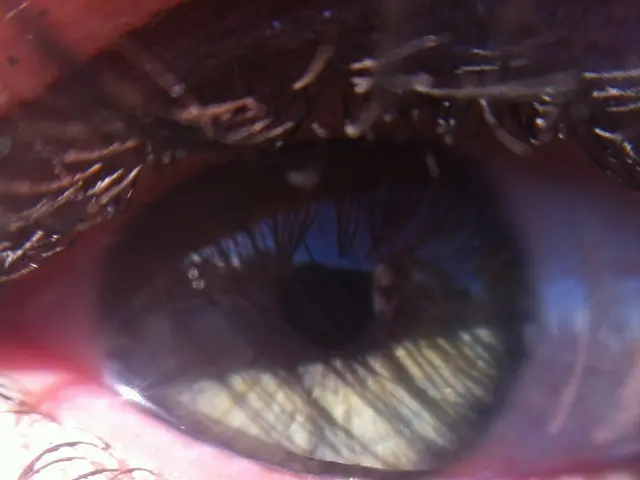 Eye discomfort: Origin, indications, assessment, remedies, and additional details