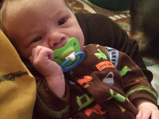 Surgical Method for Lifting Breasts