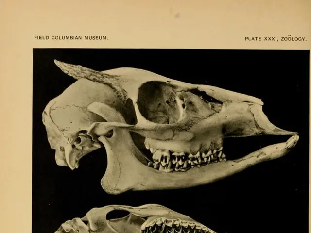 Genetic traces of Neanderthals could be linked to a condition characterized by brain protrusion...