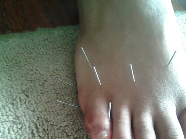 Diagnostic Examinations for Non-Hodgkin Lymphoma: Explanation of Tests, Procedures, and Findings