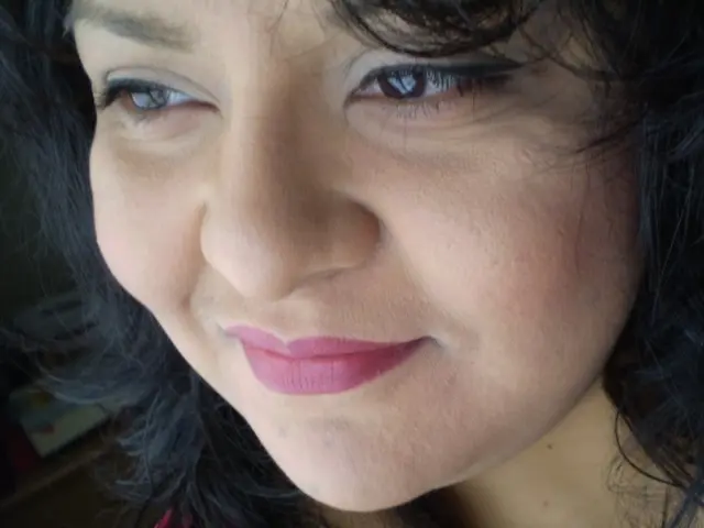 Cemre Baysel undergoes a breast operation and releases an image from the hospital